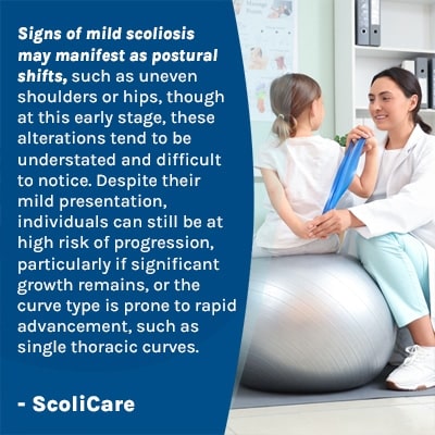 A visual representation of the quote from the text starting with “Signs of mild scoliosis may manifest "