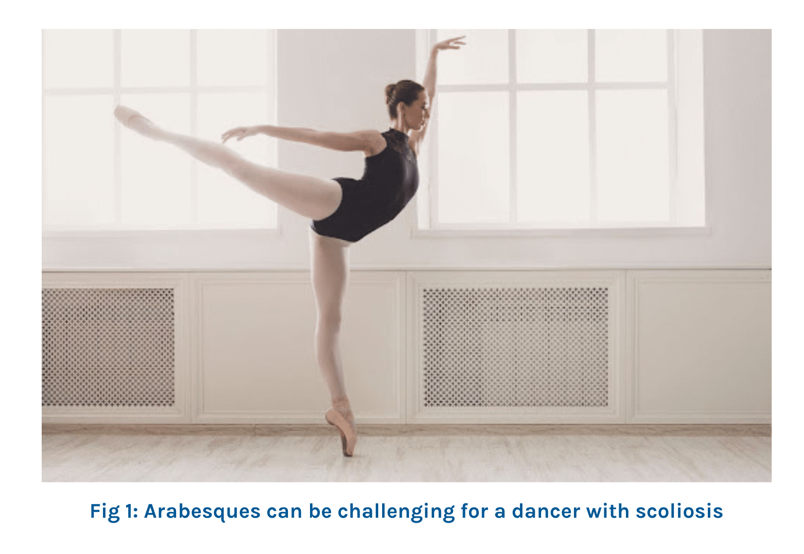 Arabesques and Scoliosis