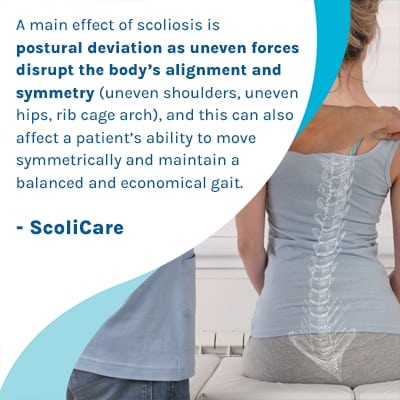 A visual representation of the quote from the text starting with “ A main effect of scoliosis is postural deviation "