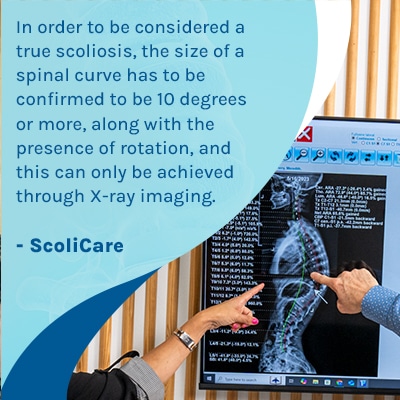 A visual representation of the quote from the text starting with “ A patient's first scoliosis X-ray “