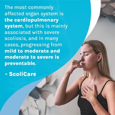 How Does Scoliosis Affect Your Organs? Key Insights