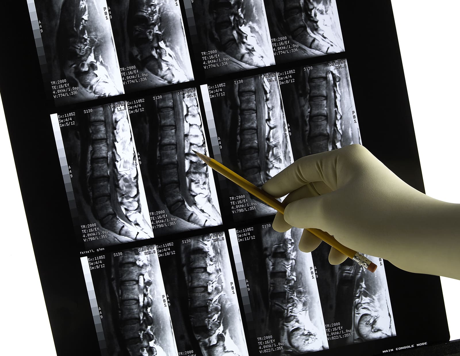 Lower back scan