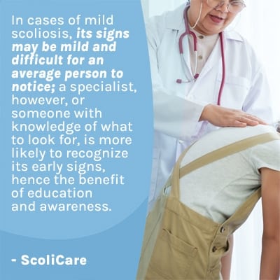 A visual representation of the quote from the text starting with “ In cases of mild scoliosis, its signs “