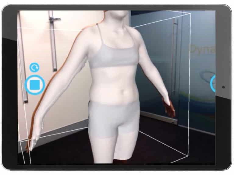BraceScan 3D Body Scanning