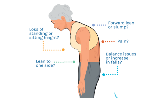 symptoms of scoliosis in an adult
