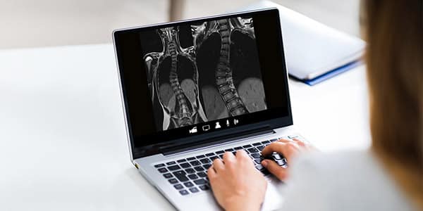 Scoliosis Insights Webinar