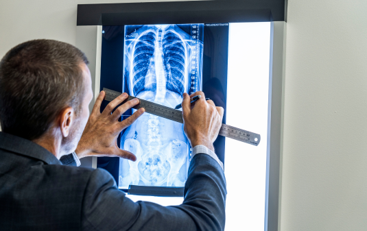 X-ray Review