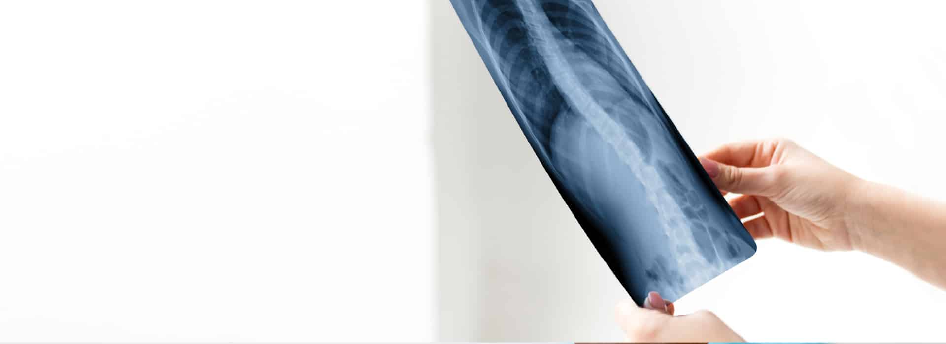 Free X-Ray Review Service