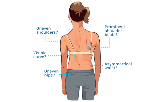 symptoms of scoliosis