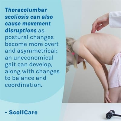 A visual representation of the quote from the text starting with “ Thoracolumbar scoliosis can also "
