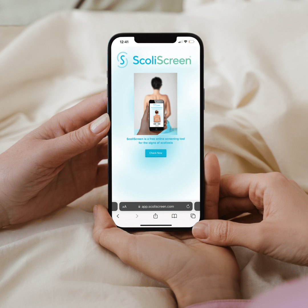 Check for signs of scoliosis in children and loved ones with the screening tool, ScoliScreen.