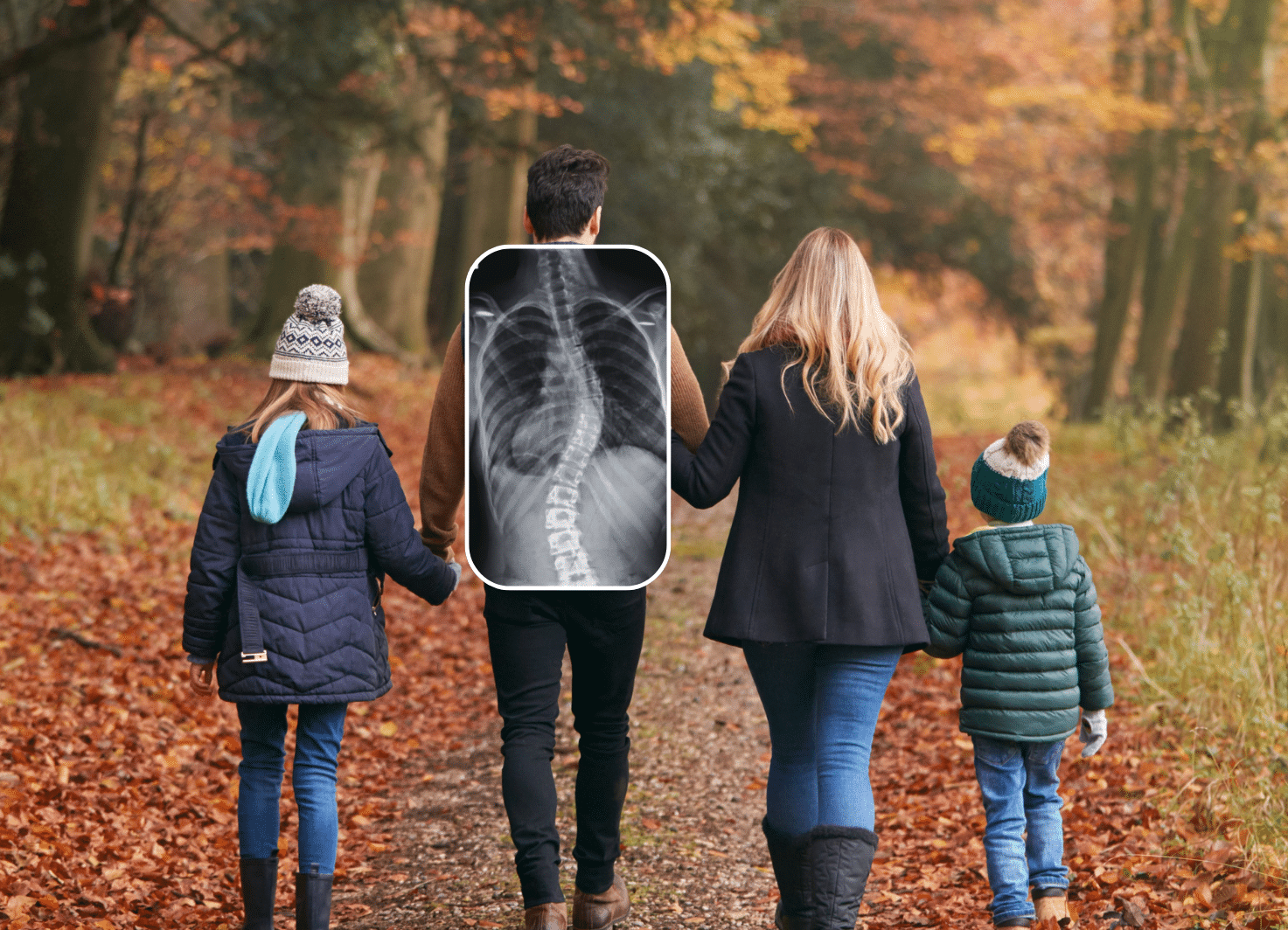 Scoliosis Doesn’t Take a Season Off - Neither Should You