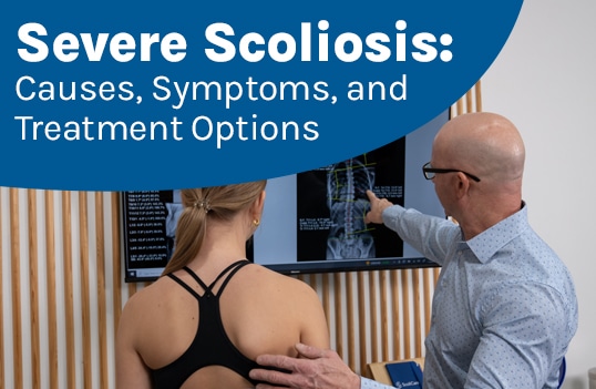 A featured image post for the blog titled: “Severe Scoliosis: Causes, Symptoms, and Treatment Options