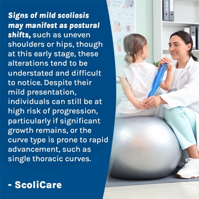 A visual representation of the quote from the text starting with “Signs of mild scoliosis may manifest "