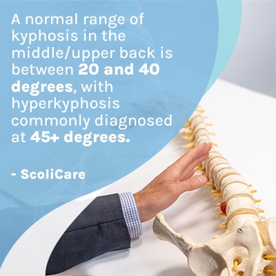 A visual representation of the quote from the text starting with “A normal range of kyphosis “