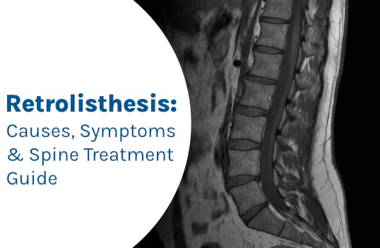 Retrolisthesis: Causes, Symptoms & Spine Treatment Guide