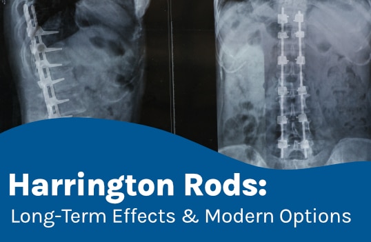 Harrington Rods: Long-Term Effects & Modern Options