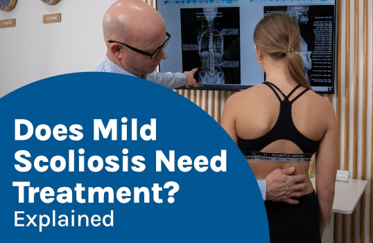Does Mild Scoliosis Need Treatment? Explained