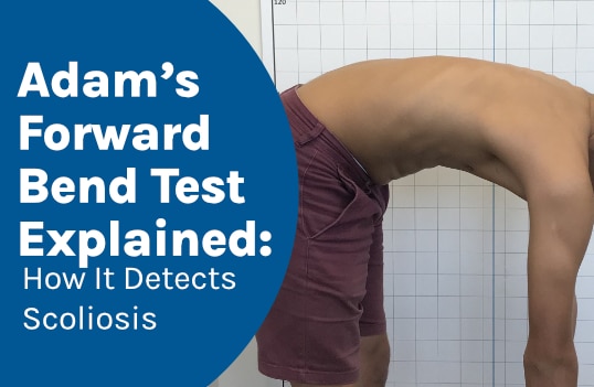 Adam’s Forward Bend Test Explained: How It Detects Scoliosis